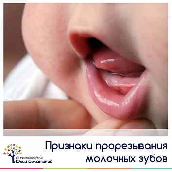 Признаки прорезывания зубов у ребёнка 