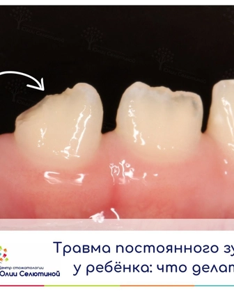 Травма постоянного зуба у ребенка: что делать?