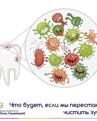 Что будет, если не чистить зубы?