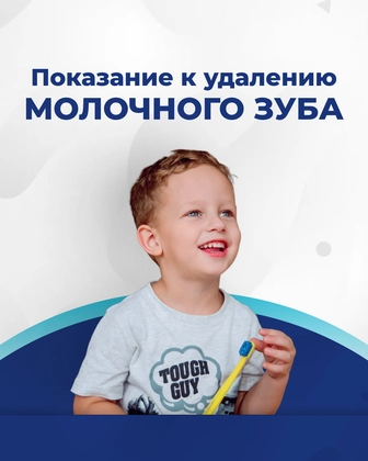 Показания к удалению молочного зуба