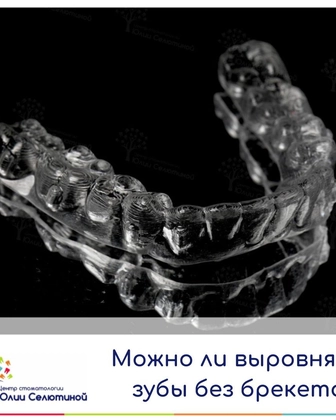 Можно ли выровнять зубы без брекетов?