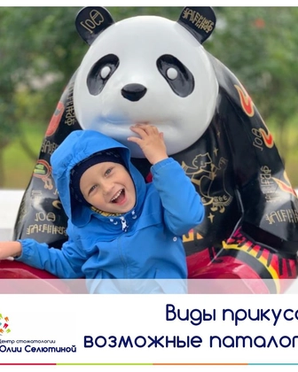 Виды неправильного прикуса