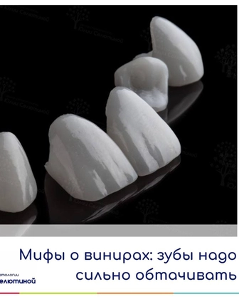 Мифы о винирах: зубы нужно сильно обтачивать