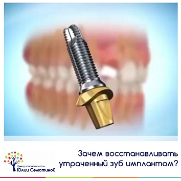 Зачем восстанавливать утраченный зуб имплантом? 