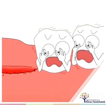 Как сохранить место, если молочный зуб утрачен преждевременно? 