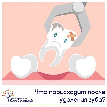 Что происходит после удаления зуба? 
