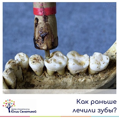 Как лечили зубы наши предки на Востоке и в Европе?