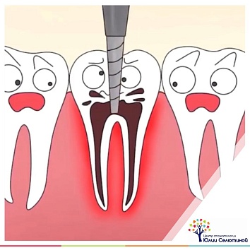 Как сохранить сильно разрушенный или депульпированный зуб? 
